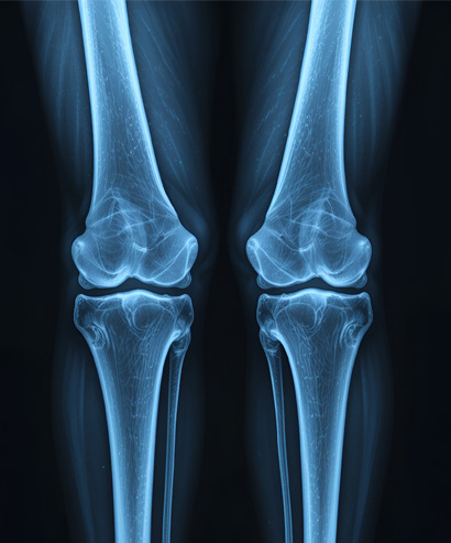 x ray joint img